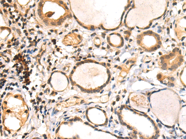 Rabbit Polyclonal Antibody to HDAC9