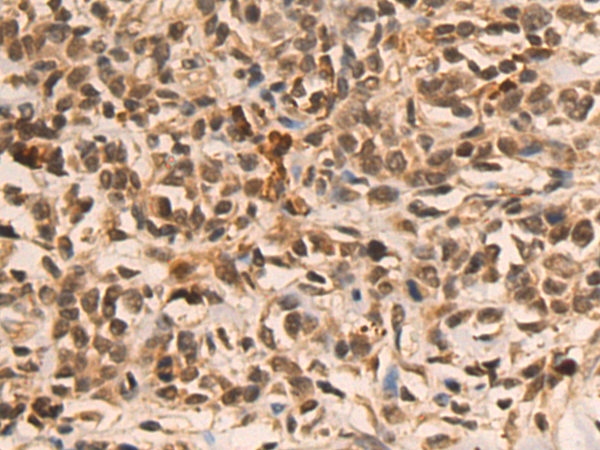 Rabbit Polyclonal Antibody to HDAC10
