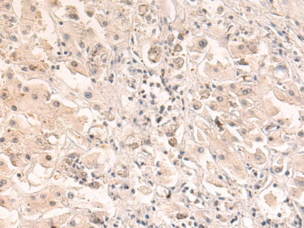 Rabbit Polyclonal Antibody to CTU1