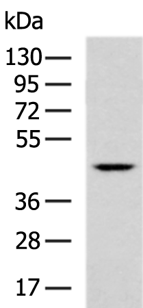 Rabbit Polyclonal Antibody to PNCK