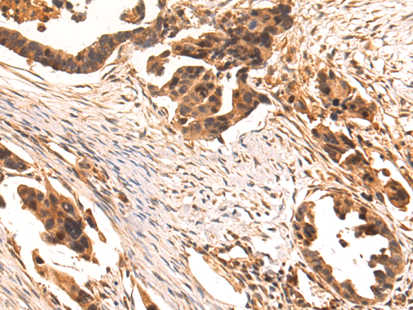 Rabbit Polyclonal Antibody to FGF13