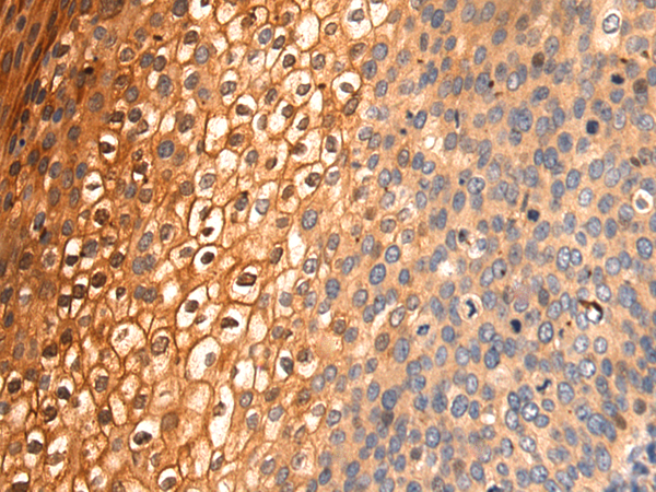 Rabbit Polyclonal Antibody to CLOCK