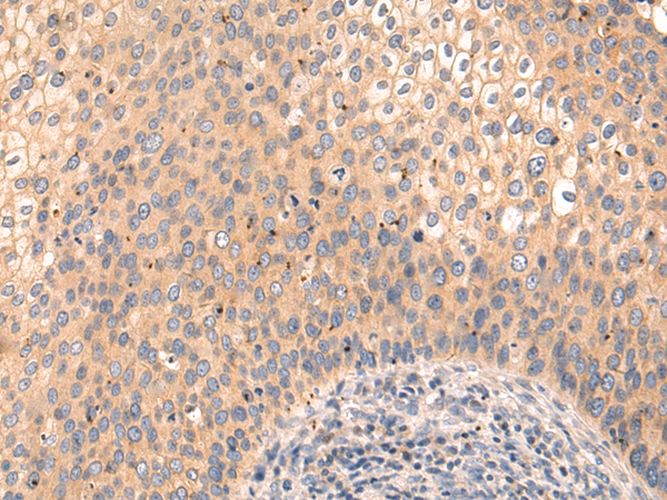 Rabbit Polyclonal Antibody to PIK3CA