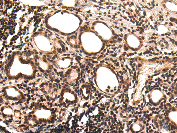 Rabbit Polyclonal Antibody to TFAP2A