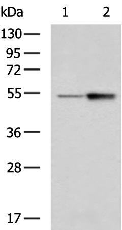 Rabbit Polyclonal Antibody to STEAP3