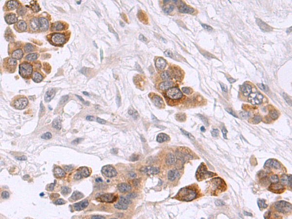 Rabbit Polyclonal Antibody to CD52