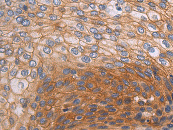 Rabbit Polyclonal Antibody to COL5A1