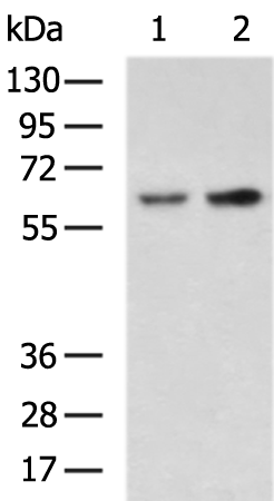 Rabbit Polyclonal Antibody to HEXB