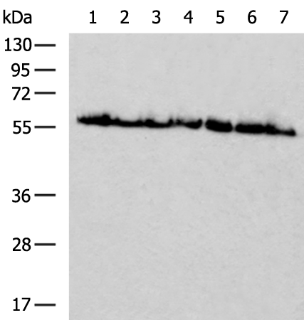 Rabbit Polyclonal Antibody to PEX14