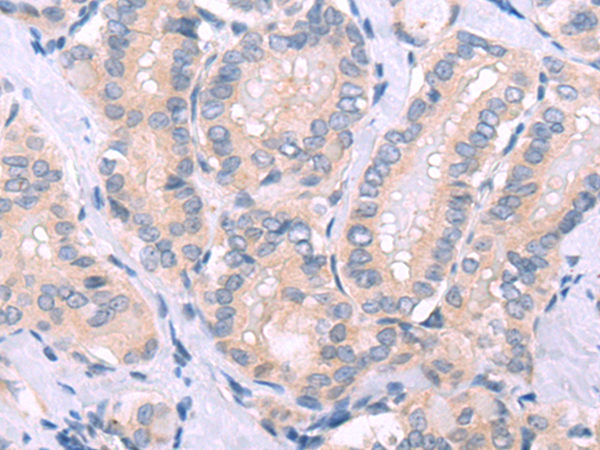 Rabbit Polyclonal Antibody to GABRA3