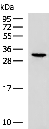 Rabbit Polyclonal Antibody to MBP
