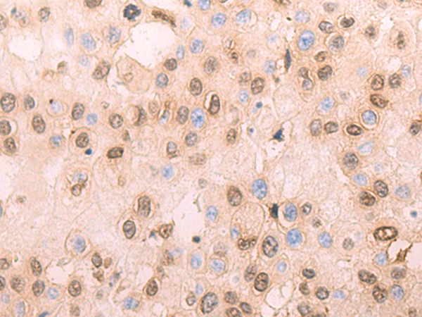 Rabbit Polyclonal Antibody to HOXA1