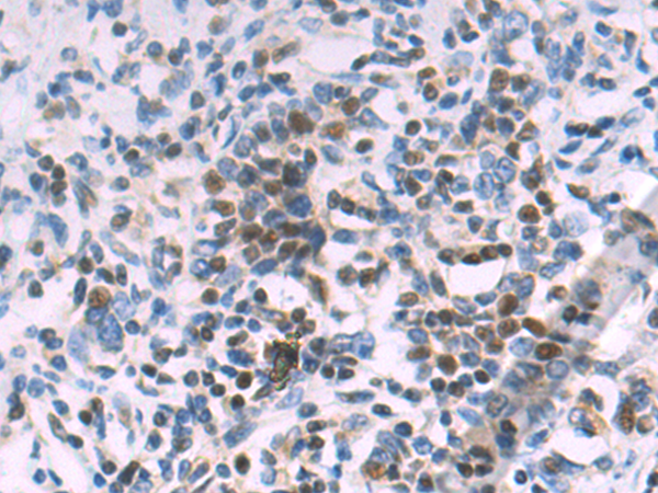Rabbit Polyclonal Antibody to PIAS3