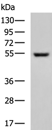 Rabbit Polyclonal Antibody to ETV1