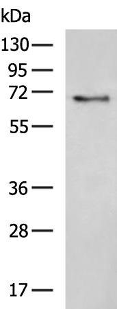 Rabbit Polyclonal Antibody to PARP2