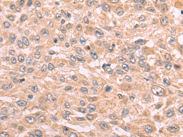 Rabbit Polyclonal Antibody to TNFAIP3
