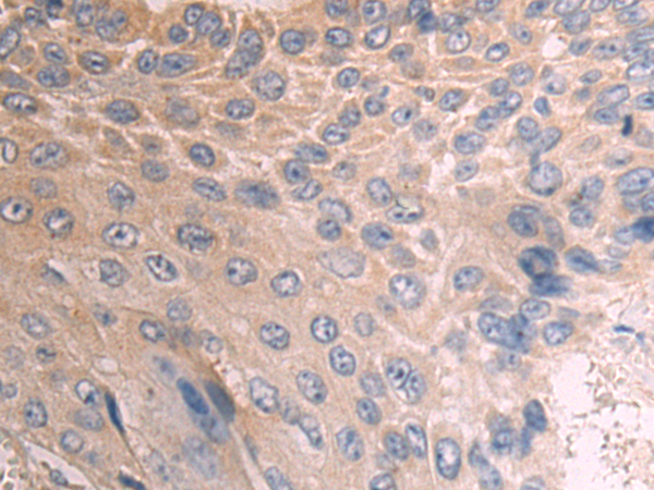 Rabbit Polyclonal Antibody to NNMT