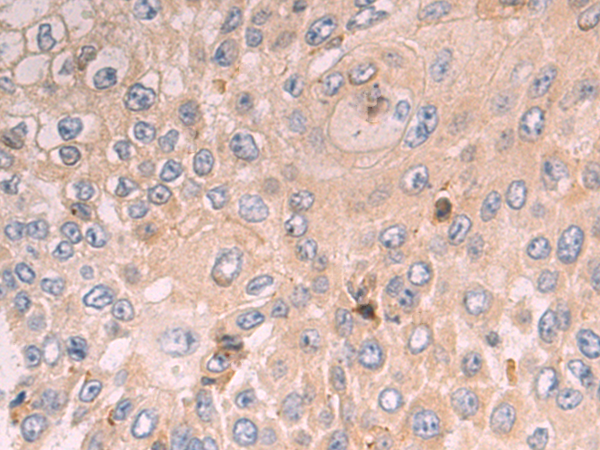Rabbit Polyclonal Antibody to SLC25A39
