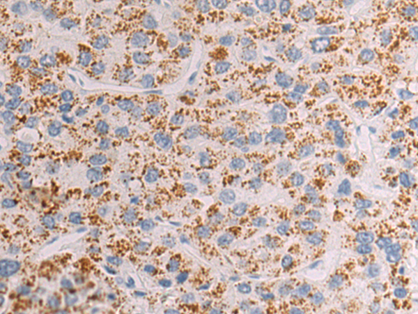 Rabbit Polyclonal Antibody to SLC22A7