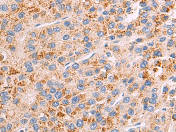 Rabbit Polyclonal Antibody to SPINK1