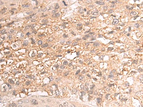 Rabbit Polyclonal Antibody to GJC2