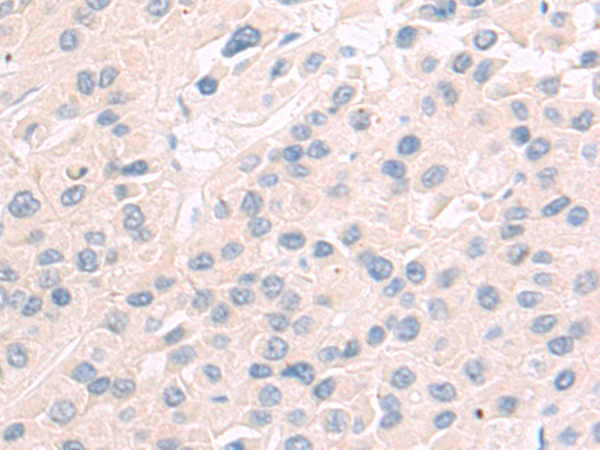 Rabbit Polyclonal Antibody to ANGPTL2