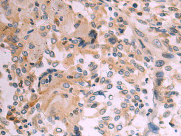 Rabbit Polyclonal Antibody to KLK15