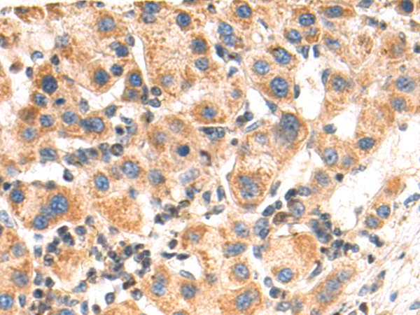 Rabbit Polyclonal Antibody to USP43