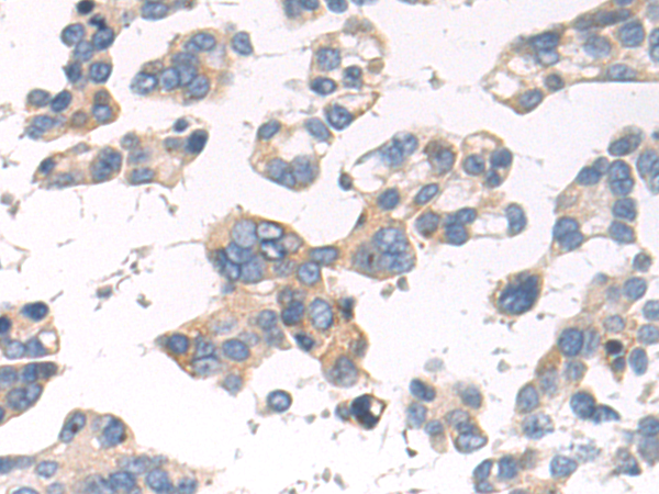 Rabbit Polyclonal Antibody to PRKN