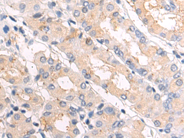Rabbit Polyclonal Antibody to LAMB1