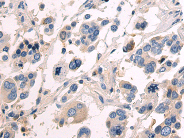 Rabbit Polyclonal Antibody to LAMA2