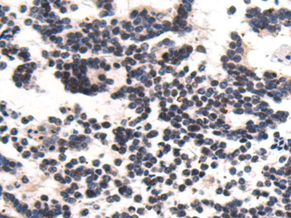 Rabbit Polyclonal Antibody to CHD4