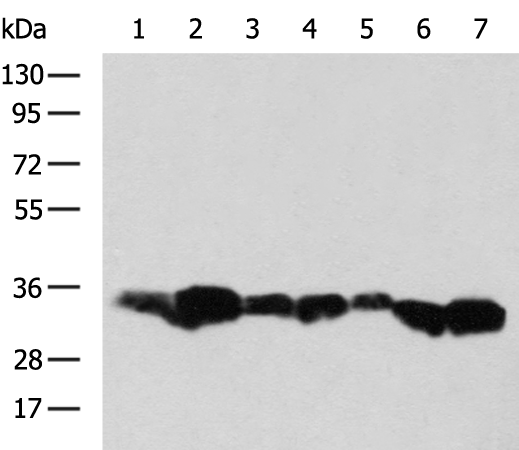 Rabbit Polyclonal Antibody to C1QBP