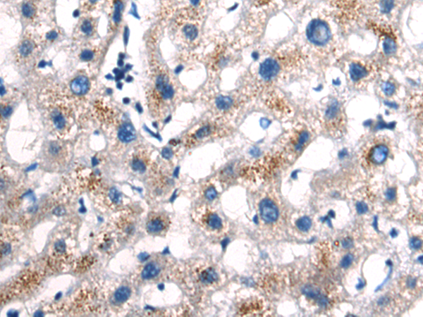 Rabbit Polyclonal Antibody to PLCE1