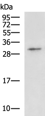 Rabbit Polyclonal Antibody to RPS4X