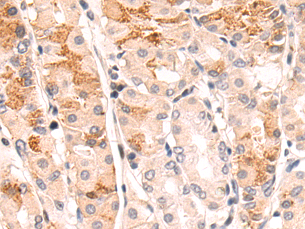 Rabbit Polyclonal Antibody to YOD1