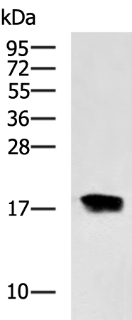 Rabbit Polyclonal Antibody to CDKN2B