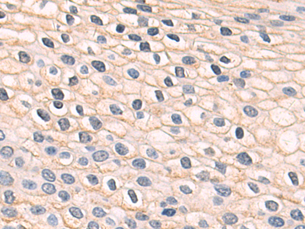 Rabbit Polyclonal Antibody to TACC1