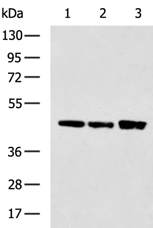 Rabbit Polyclonal Antibody to CTSD