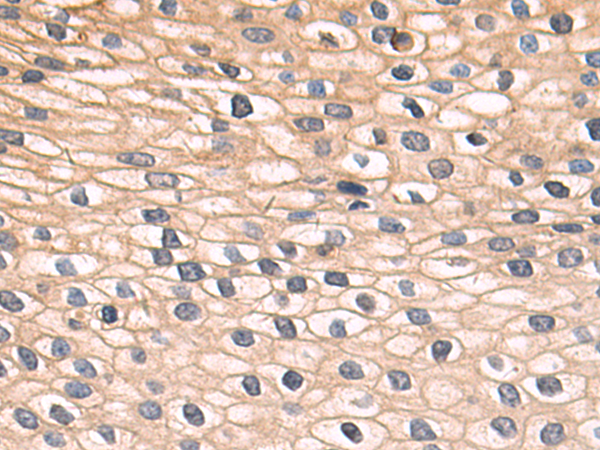 Rabbit Polyclonal Antibody to FOLR1