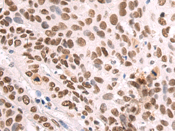 Rabbit Polyclonal Antibody to SYNCRIP