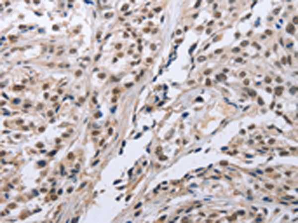 Rabbit Polyclonal Antibody to FN1