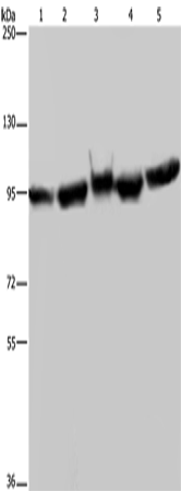 Rabbit Polyclonal Antibody to HSP90AA1