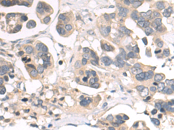 Rabbit Polyclonal Antibody to EPHX1