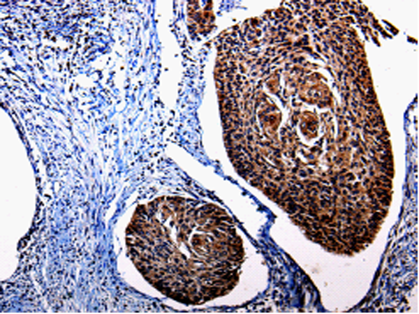 Rabbit Polyclonal Antibody to KLK3