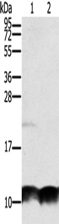 Rabbit Polyclonal Antibody to UBB