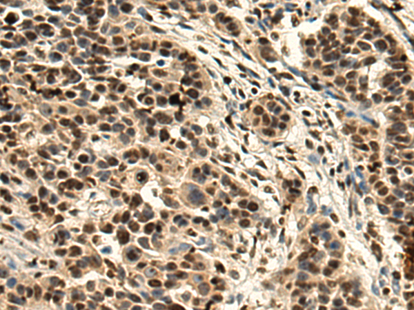 Rabbit Polyclonal Antibody to PCP4