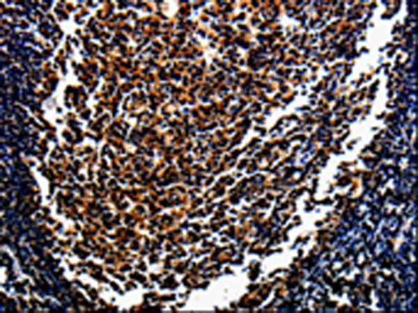 Rabbit Polyclonal Antibody to MAGEA4