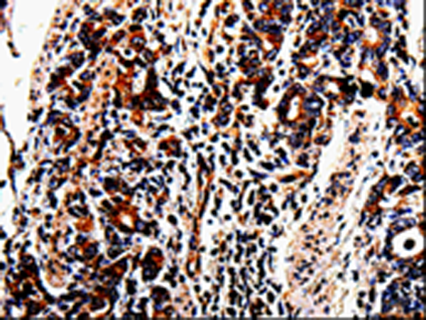 Rabbit Polyclonal Antibody to ACSBG2