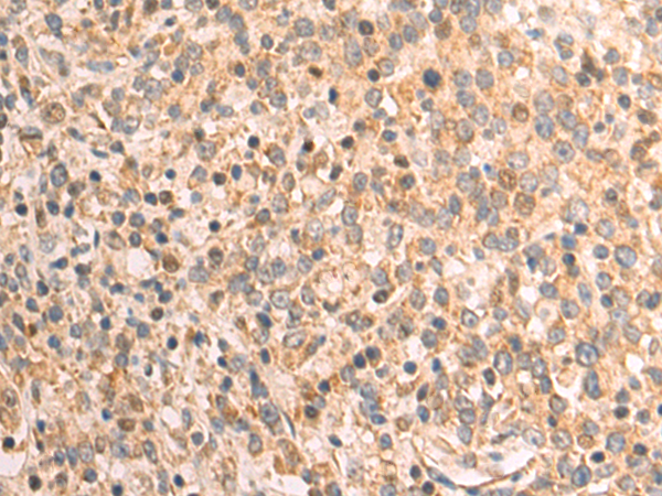 Rabbit Polyclonal Antibody to DAZ4
